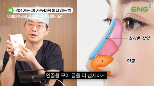 비염코수술