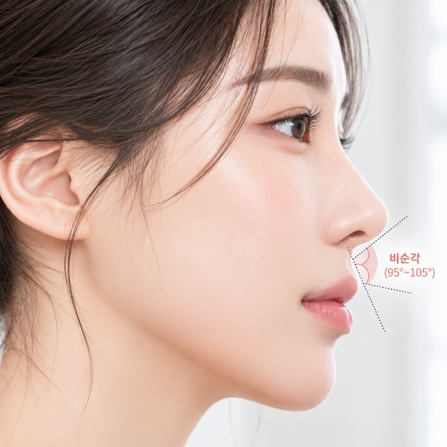 비순각교정 시 확인하는 코끝과 윗입술 사이 비순각 95~105도 측면 이미지