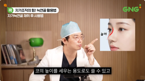 지앤지이비인후과 병원 의료진이 설명하는 늑연골을 이용한 코 높이 조절 방법
