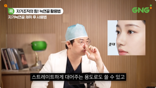 자가늑연골을 활용한 콧대 지지 및 코 구조 보강 방법에 대한 의료진 설명