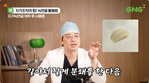 채취한 자가늑연골을 잘게 분쇄하는 과정에 대한 의료진 설명