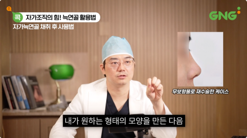 무보형물 코재수술 사례를 통한 코 모양 교정 방법 설명
